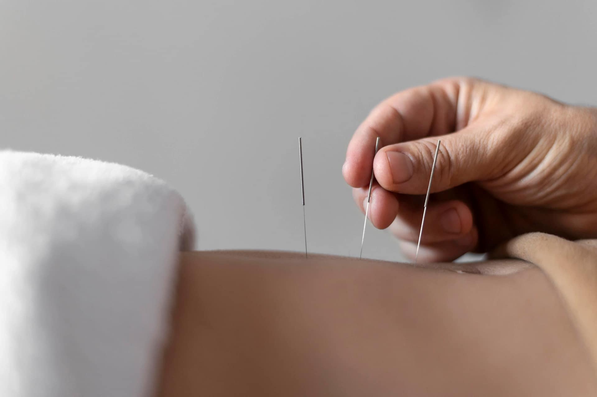 Remedial Massage Treatment Preston