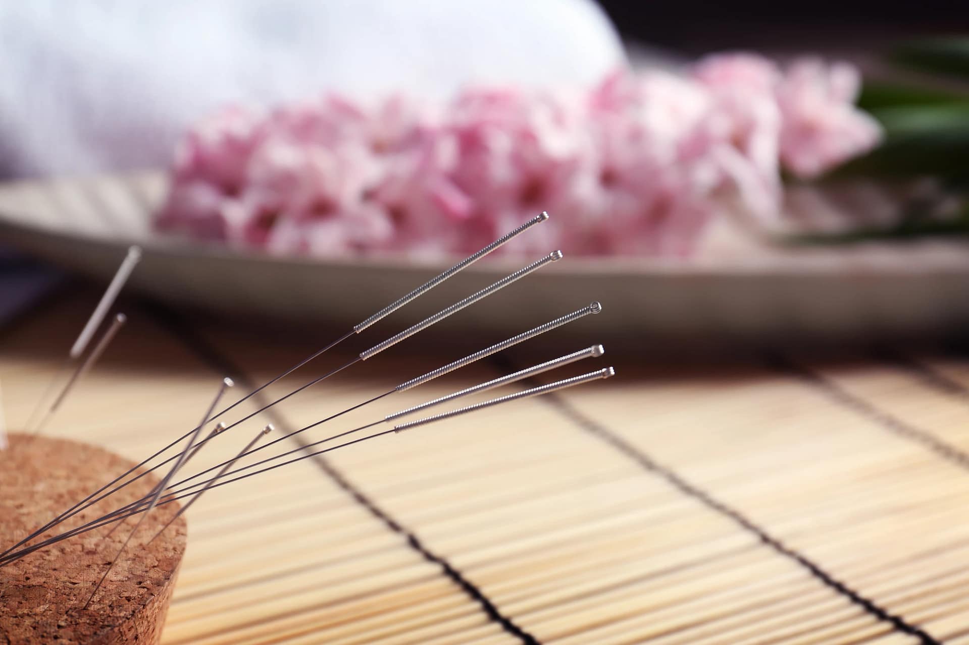 Best Acupuncture Preston